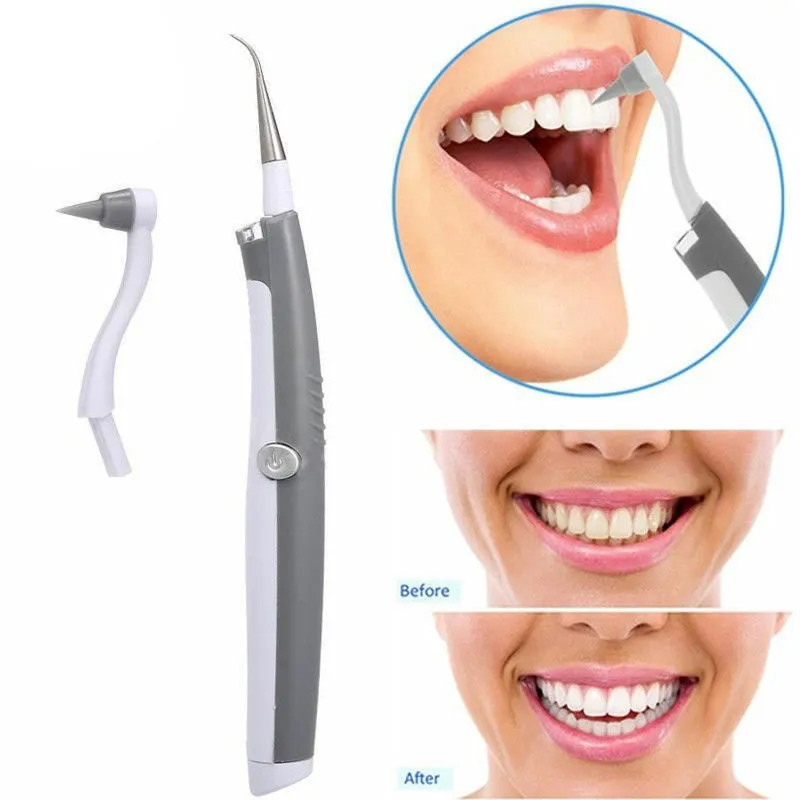 Set Limpiador De Dientes Removedor De Placas